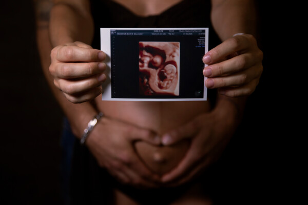 fotografia premaman gravidanza mamma gemelli papà maschio femmina